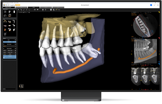 Automated-dental-segmentation-improving-CBCT-interpretation-and-anato Automated-dental-segmentation-improving-CBCT-interpretation-and-anato