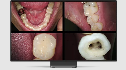 CS-1300-broad-image-range.webp CS-1300-broad-image-range.webp