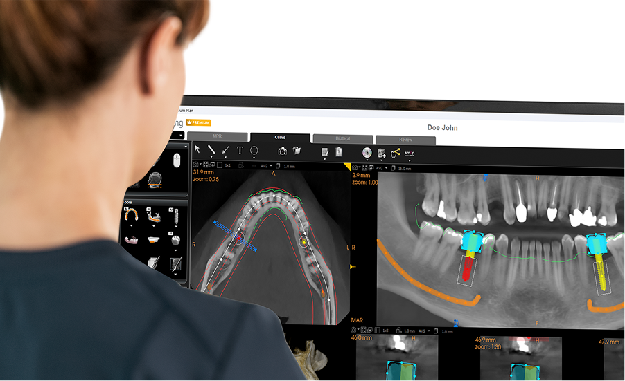 ai-assisted-implant-planning-in-3d-dental-imaging-software-using- ai-assisted-implant-planning-in-3d-dental-imaging-software-using-