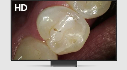 cs-1300-hd-clarity.webp cs-1300-hd-clarity.webp