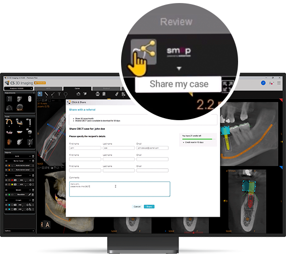 sharing-3d-cbct-cases-securely-with-referrals-using-cs-3d-imaging sharing-3d-cbct-cases-securely-with-referrals-using-cs-3d-imaging